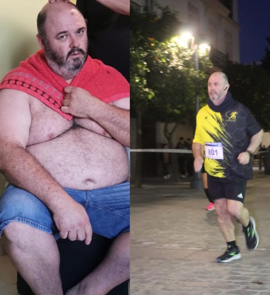 Antes y después de Migue 1